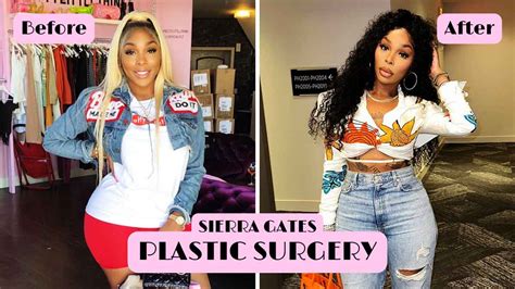 surgery sierra from love and hip hop|‘Love & Hip Hop: Atlanta’ star says she has been ...